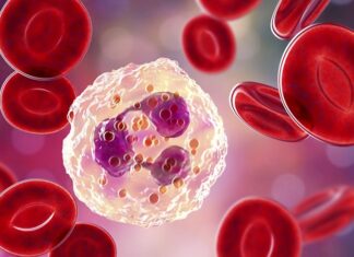 İnflamasyon, vücudun doğal savunma mekanizmasının bir parçası olsa da, kronik hale geldiğinde ciddi sağlık sorunlarına yol açabilir. Bu nedenle inflamasyon karşıtı diyet, hem inflamatuvar süreçleri azaltmak hem de genel sağlığı desteklemek için önemli bir beslenme yaklaşımı olarak öne çıkıyor. Antioksidan ve antiinflamatuvar özellik taşıyan besinlerin düzenli tüketimi, bağışıklık sistemini güçlendirir ve enerji seviyelerini dengeler. Konulu bir haber görseli.