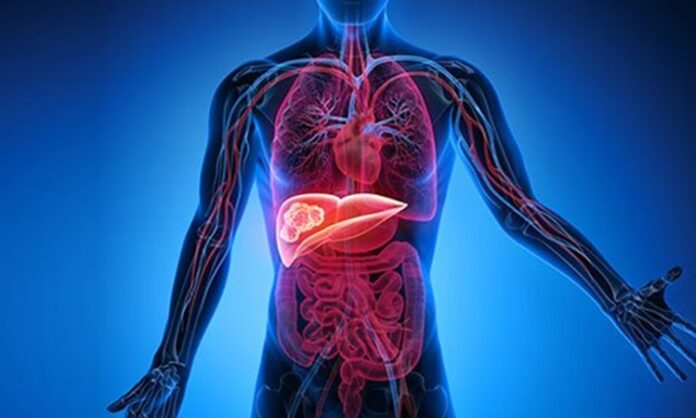 Karaciğer Temizleme Diyeti ile Sağlıklı Bir Vücut İçin Doğal Arınma Rehberi Karaciğer, vücudun en önemli detoks organlarından biridir ve sağlıklı çalışması genel sağlık açısından kritik bir rol oynar. Modern yaşamda işlenmiş gıdalar, alkol ve stres gibi faktörler karaciğerin yükünü artırabilir. Bu nedenle karaciğer temizleme diyeti, vücudu toksinlerden arındırmak, metabolizmayı desteklemek ve enerji seviyelerini yükseltmek için etkili bir yöntem olarak öne çıkıyor. Bu diyet, doğru uygulandığında hem besleyici hem de güvenli bir yaşam tarzı sağlar. Konulu bir haber görseli.