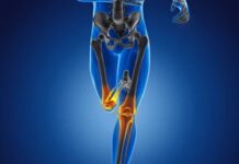 Kemik sağlığı, yaşamın her döneminde korunması gereken temel sağlık unsurlarından biridir. Çocukluk ve ergenlikte kemik gelişimi, yetişkinlikte kemik yoğunluğunun korunması, ileri yaşlarda ise kemik kaybının yavaşlatılması büyük önem taşır. Bu süreçlerin tamamında kemik güçlendirici diyet, iskelet sistemini destekleyen en etkili yaşam tarzı unsurlarından biri olarak öne çıkar. Doğru beslenme alışkanlıkları, kemiklerin dayanıklılığını artırırken kırık ve osteoporoz riskini azaltmaya yardımcı olur. Konulu bir haber görseli.