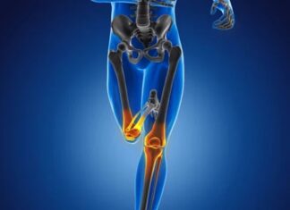 Kemik sağlığı, yaşamın her döneminde korunması gereken temel sağlık unsurlarından biridir. Çocukluk ve ergenlikte kemik gelişimi, yetişkinlikte kemik yoğunluğunun korunması, ileri yaşlarda ise kemik kaybının yavaşlatılması büyük önem taşır. Bu süreçlerin tamamında kemik güçlendirici diyet, iskelet sistemini destekleyen en etkili yaşam tarzı unsurlarından biri olarak öne çıkar. Doğru beslenme alışkanlıkları, kemiklerin dayanıklılığını artırırken kırık ve osteoporoz riskini azaltmaya yardımcı olur. Konulu bir haber görseli.